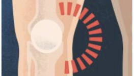 Inner-knee-pain