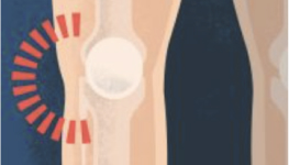 A physio taping a patient's knee